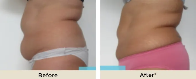 BA_thumbnail_cristal_new