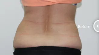 Cristal-Pro-1-Before