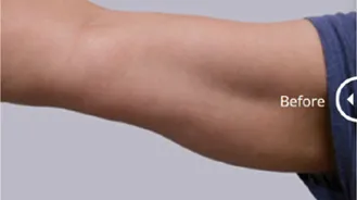 Cristal-Pro-2-Before