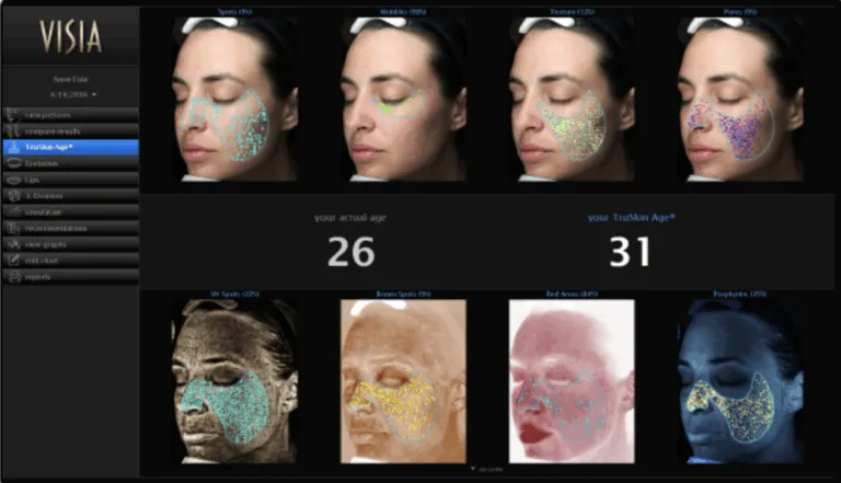 Rakus-Visia-Results