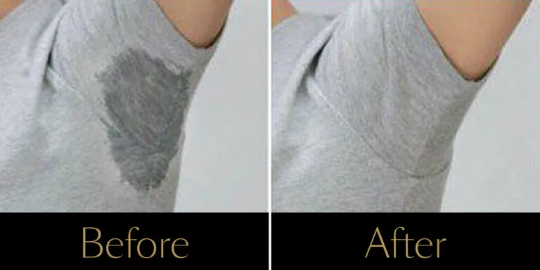 rakus-excesssweating-ba2