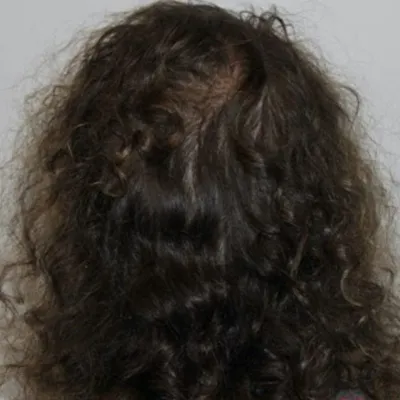 rakus-keravive-beforeafter4