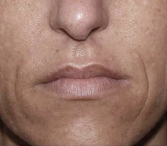rakus-secret-beforeafter5