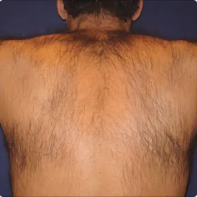rakus-soprano-beforeafter3