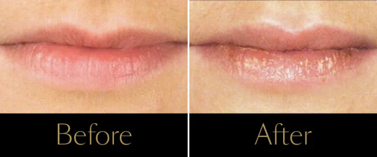 BA-Lips-1
