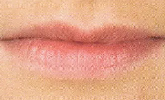 RR_lips_before