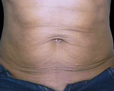 Rakus-Exilis-BAs