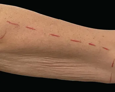 Rakus-Exilis-BAs3