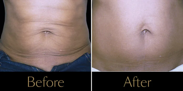 Rakus-Exilis-Gallery2