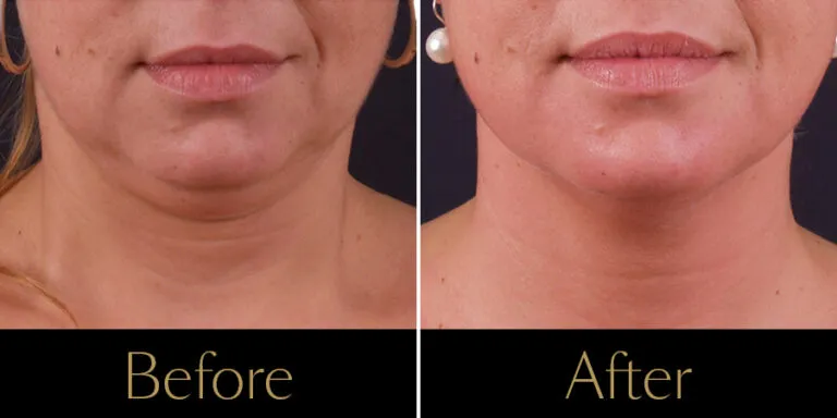 Rakus-Exilis-Gallery3