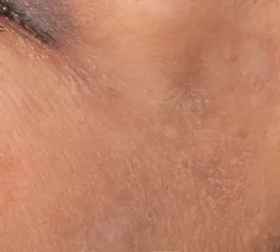 rakus-ultraclear-beforeafter11